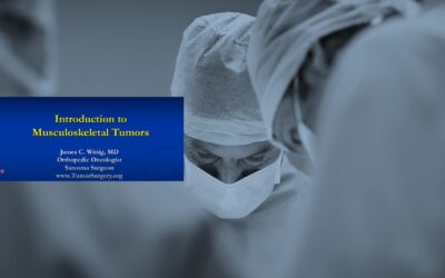 Musculoskeletal Tumors: Symptoms, Diagnosis, and Treatment